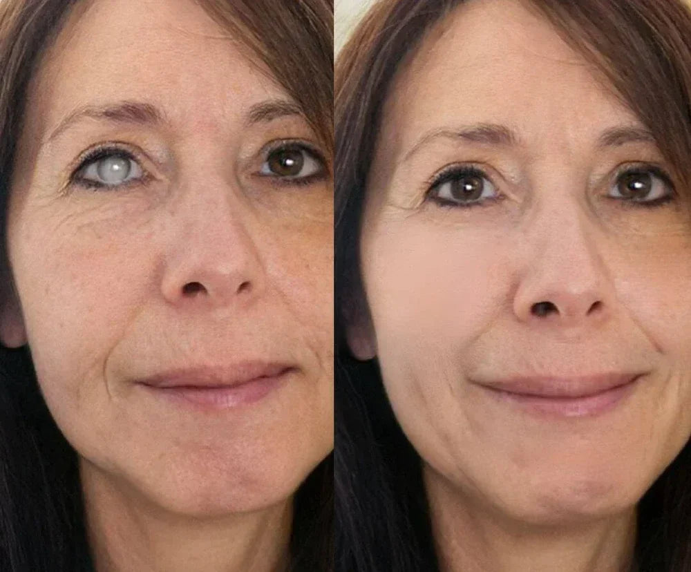 Nano Eye Roller Serum