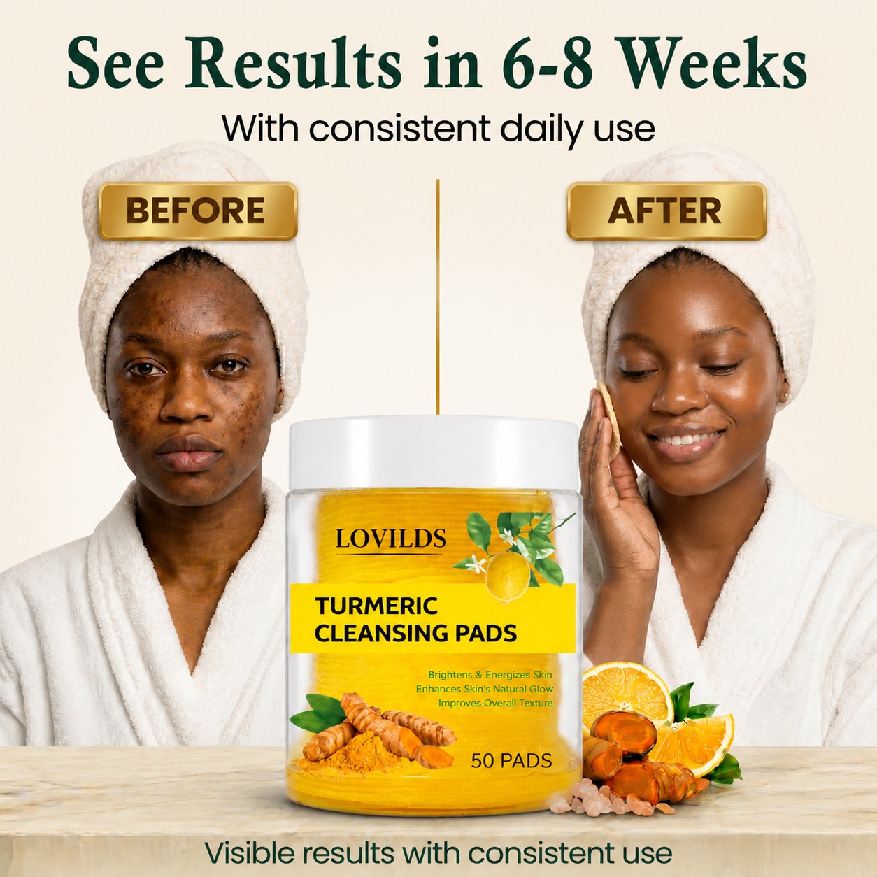 LOVILDS Turmeric Kojic Acid Cleansing Pads