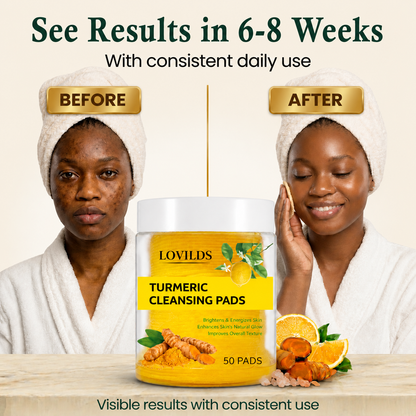 LOVILDS Turmeric Kojic Acid Cleansing Pads