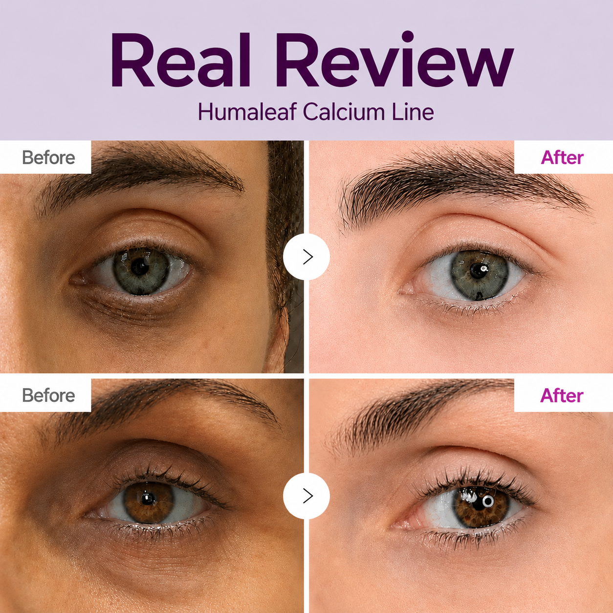 🔥LAST DAY 50% OFF!!Humaleaf Korean Calcium Dark Spot Eye Cream