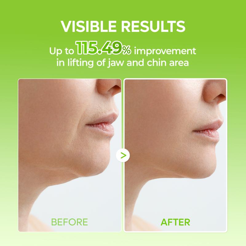 COOLING V-LINELIFTING MEWING BAND (4x Masks Per Pack)