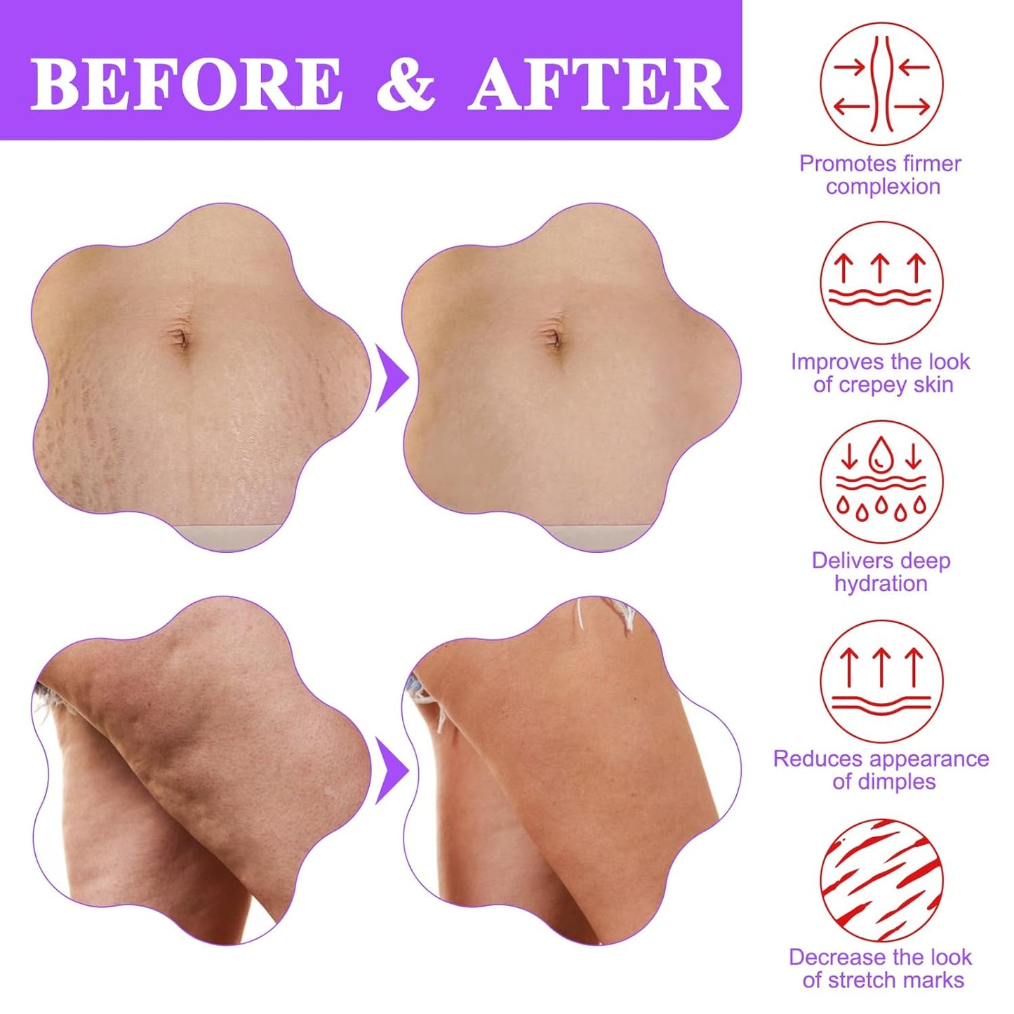 ✨ For Loose Belly Skin & Stretch Marks — Insideefy Tighten & Smooth Belly Cream | Visibly Firmer in Just 7 Days 💜