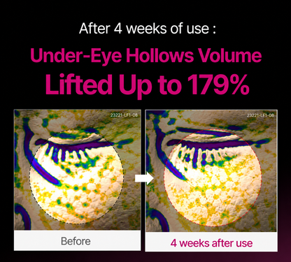 🔥LAST DAY 50% OFF!!Humaleaf Korean Calcium Dark Spot Eye Cream